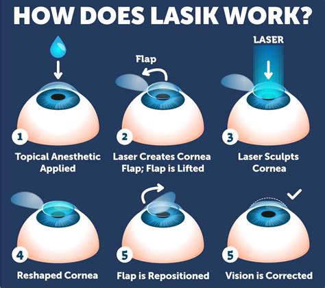 LASIK / Refractive Surgery .